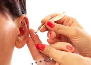 EAR3